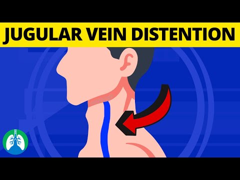 What is Jugular Venous Distention? (Medical Definition and Explanation)