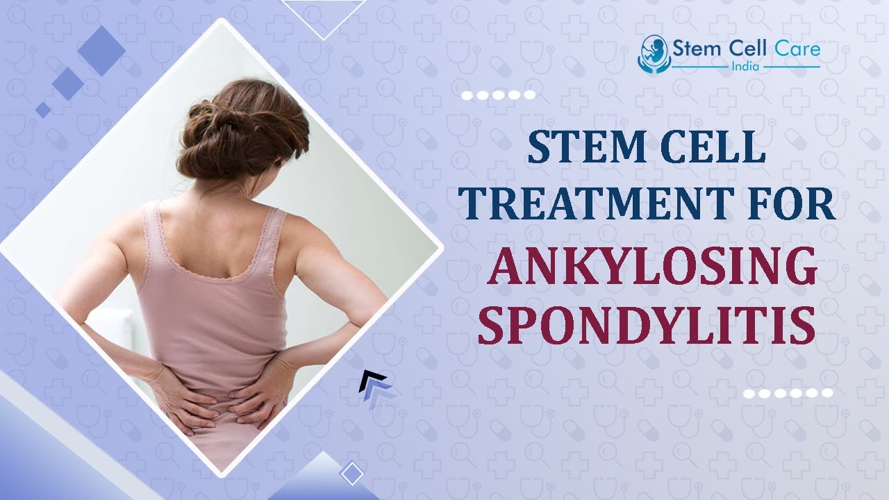 Best Stem Cell Center In Delhi | Ankylosing Spondylitis Treatment | Best Stem Cell Treatment 