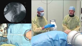 Cranial Reduction Techniques with GW Tongs - Rick Sasso, MD