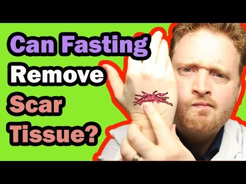 Fasting Scar Tissue - How Fasting Removes Scar Tissue (Part 2)