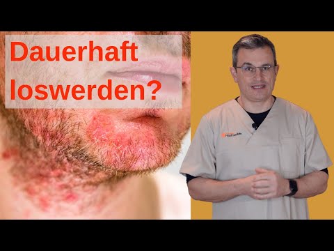 OFT nervig, SELTEN schlechtes Omen: Seborrhoische Dermatitis (Achtung: ausführliches Video)