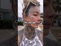 One year of tattoo removal progress