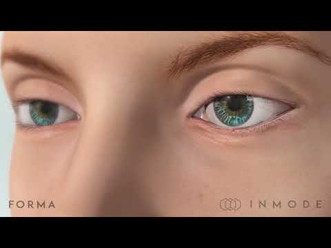 The Latest Dry Eye Treatment - Now at Grand Eye Care