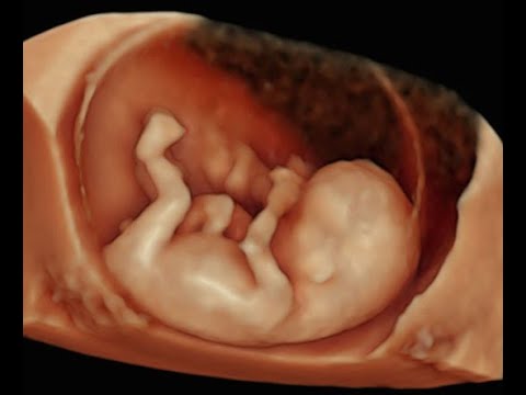 How to Perform 3D Scan of the Baby at 12 Weeks of Pregnancy