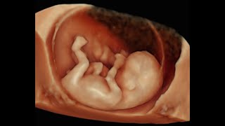 How to Perform 3D Scan of the Baby at 12 Weeks of Pregnancy