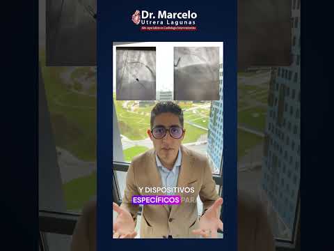 Marcelo Utrera Lagunas-141