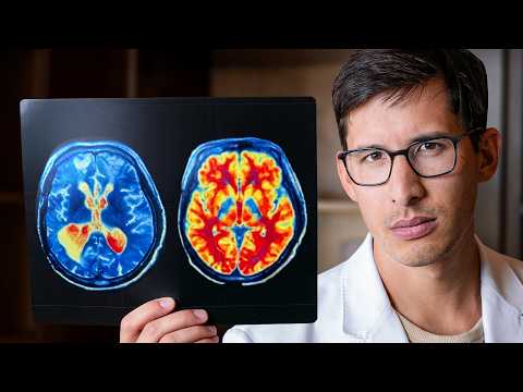 Ozempic Mental Health Effects, Explained for Beginners