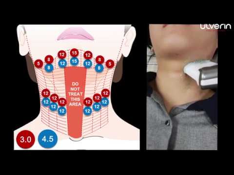 Przenośne HIFU ULVERIN | Intobeauty