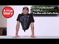 The Man With Half A Body: The FULL Documentary | Nine Lives Media