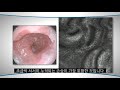 Clip 3