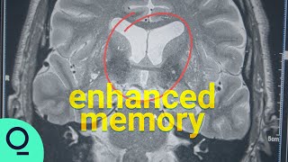 Why London&#39;s Cab Drivers Have Different Brains