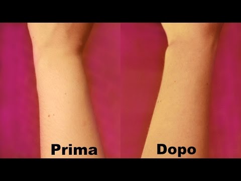 La decolorazione attiva sbatte le risposte di effetto di decolorazione doppie fino a rendere cremoso Come loro per prendere lentiggini