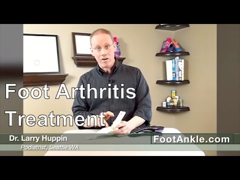 Artroza genunchiului și medicamente