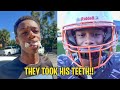 They PULLED His TEETH OUT Last Football Game Before PLAYOFFS