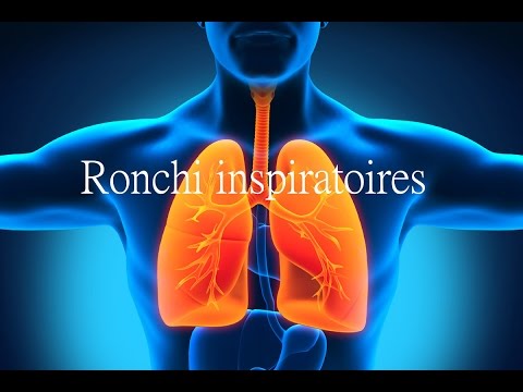 Ronchi inspiratoires