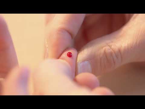 MADx ALEX² Flexible.Reliable.Affordable