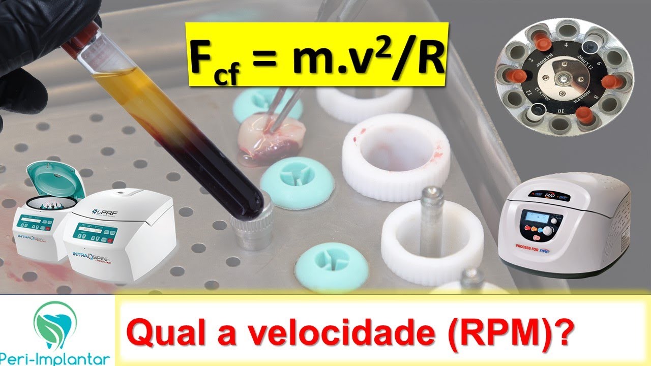 Dominando o PRF em QUALQUER centrífuga!