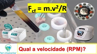 Dominando o PRF em QUALQUER centrífuga!