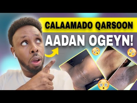 13 Calaamadood In Jidhkaagu Bukaan Yahay (Hubi Hadda!)