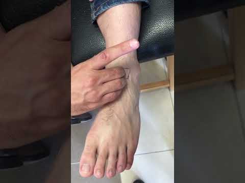 dorsalis pedis artery palpation