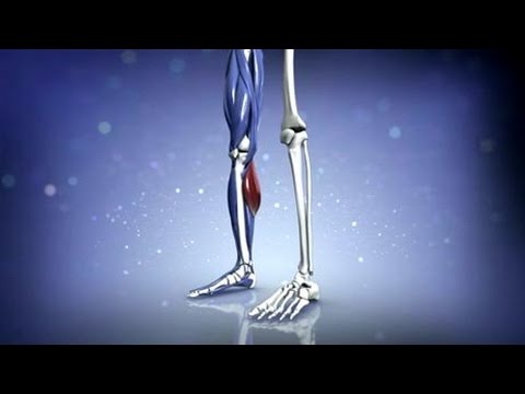 Wie entstehen Muskelkrämpfe?