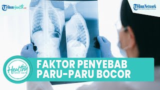 Faktor Risiko Seseorang Alami Paru-paru Bocor Bisa Picu Kematian, Ini 4 Penyebab dan Cara Mencegah