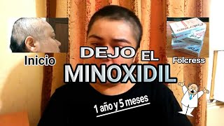 Dejo el MINOXIDIL | Alopecia