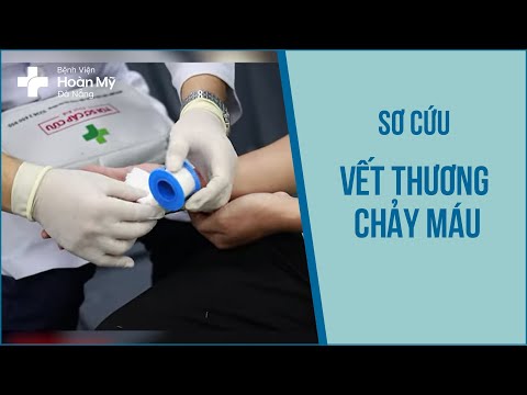 Sơ cứu vết thương chảy máu — BV Hoàn Mỹ Đà Nẵng
