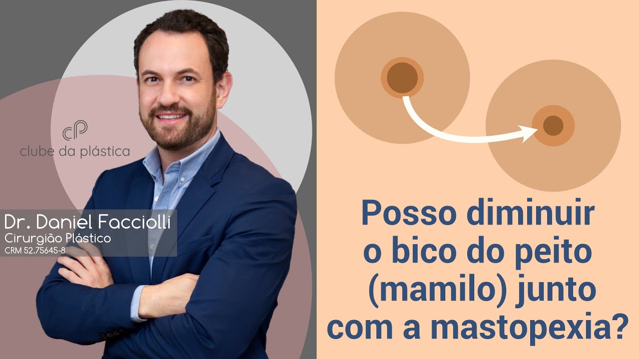 Clube da Plástica: Posso diminuir o bico do peito (mamilo) junto com a mastopexia