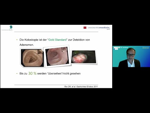 Update zur endoskopischen Resektion