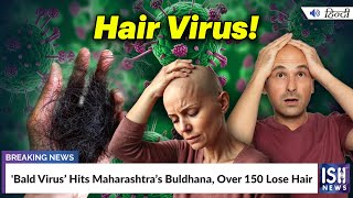 'Bald Virus’ Hits Maharashtra’s Buldhana, Over 150 Lose Hair