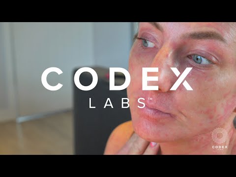 Topical Steroid Withdrawal: Time for Prevention