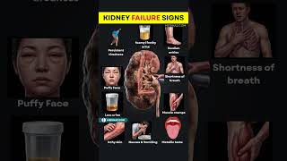 Top 10 Signs of Kidney Failure You Should Never Ignore