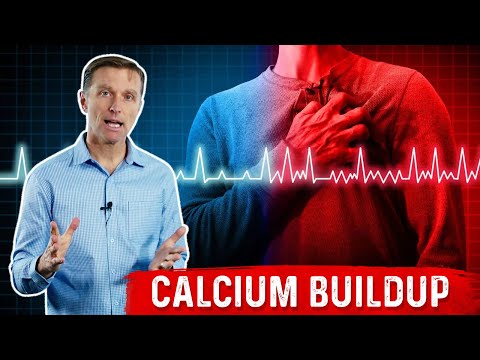 Arrhythmias Are Excess Calcium