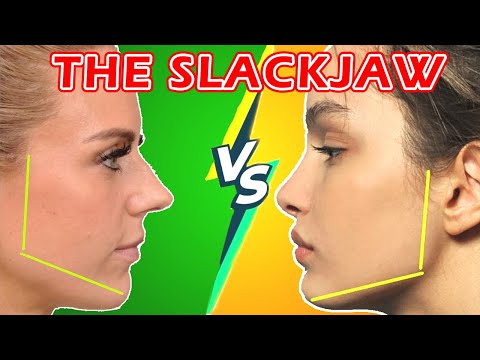 Mouth-Breathing Vs Facial Aesthetics || Mouth Breathers Explained