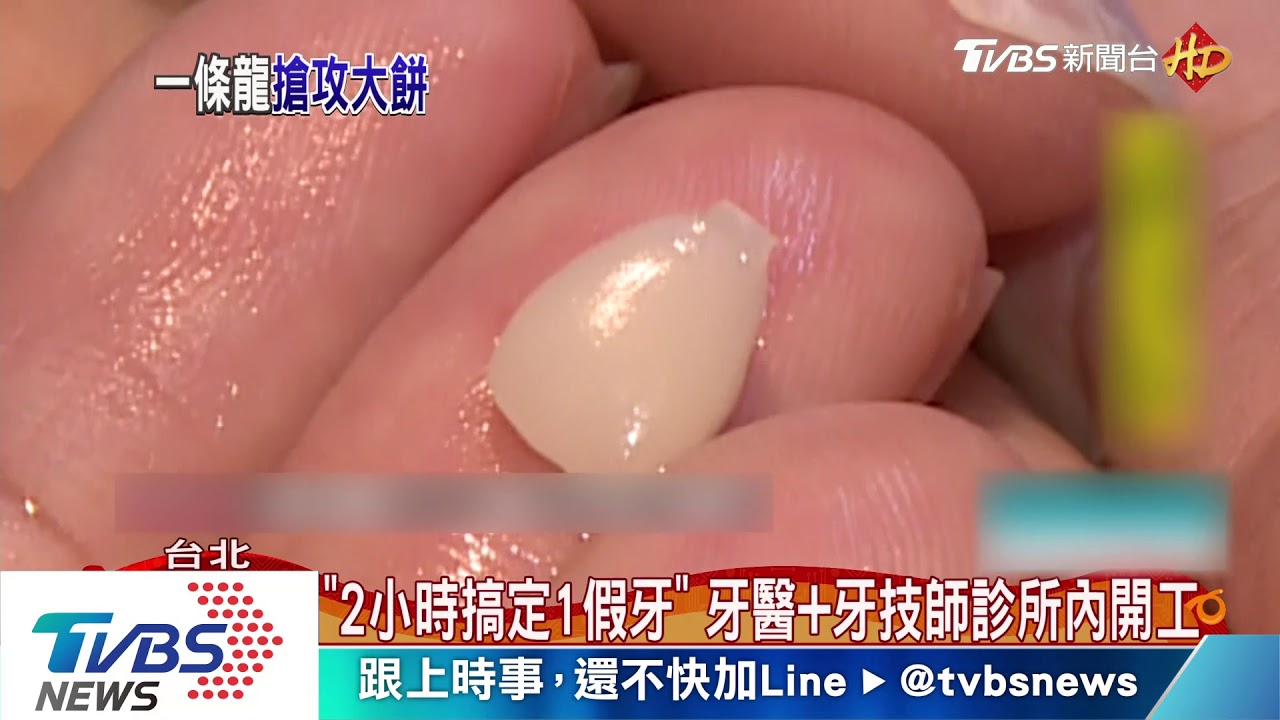 換假牙不用等一週! 牙醫診所加牙技師2hrs搞定
