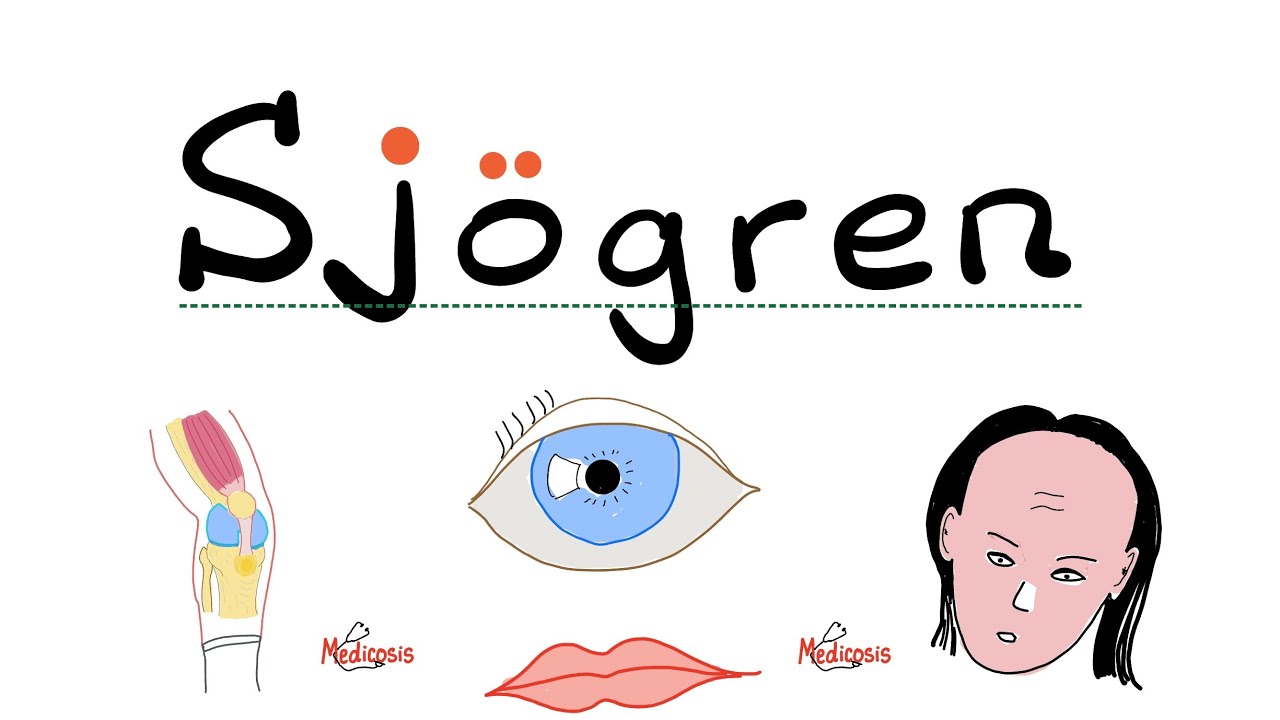 Sjögren Syndrome - Dry eyes, Dry mouth, Arthritis - Rheumatology Series