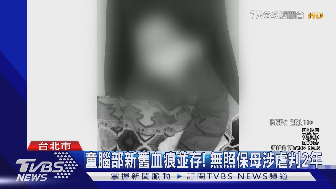 童腦部新舊血痕並存! 無照保母涉虐判2年