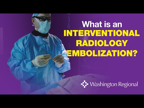 Embolization in Interventional Radiology