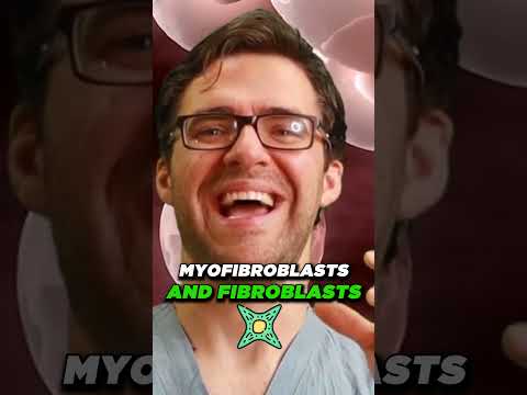 What not to do with plantar fasciitis What is plantar fasciitis