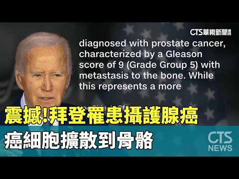 震撼！　拜登罹患攝護腺癌　癌細胞擴散到骨骼