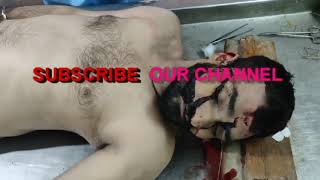 Dead Body Postmortem