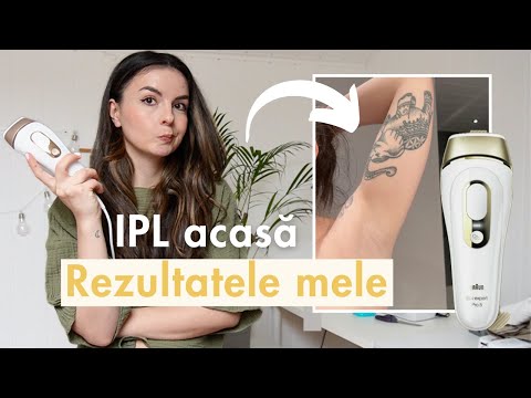 Epilarea definitivă acasă, funcționează? Review Braun IPL Pro 5 vs. Phillips Lumea | Rezultate ipl