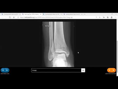 TEAM FRCR 2B Viva Practice Session (MSK module). 28th Nov, 2020.