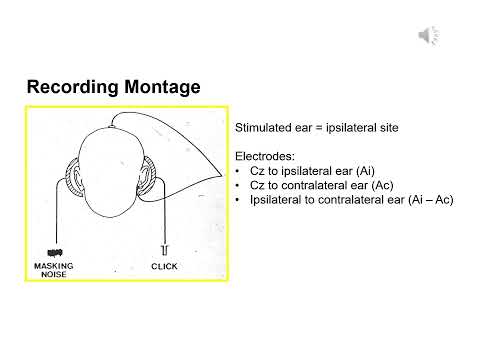 B2 BAEP theory   practical aspects