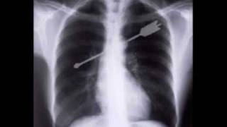 ese loco soy yo- arrolladora