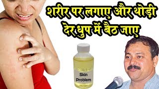 Rajiv Dixit - एलर्जी और त्वचा के रोग का ऐसा घरेलू और सस्ता इलाज कही नहीं मिलेगा