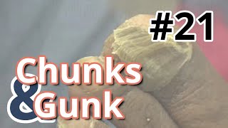 Chunks and Gunk #22 Another Big Toe (2023)
