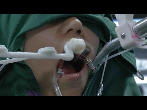 Un robot dentiste en Chine