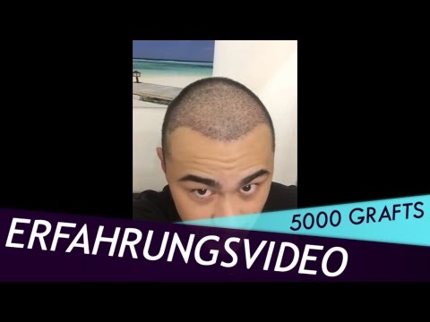 Ð ° нР° Ñ, Ð¾Ð¼Ð¸Ñ Ð »Ñ окÑ, Ðμвого ÑƒÑ Ñ, Ð ° вР° нР° Ñ € ÐμнÑ, гÐμнÐμ Artra Creme Gelenke Preis